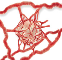 Tumor Angiogenesis Tumor Angiogenesis